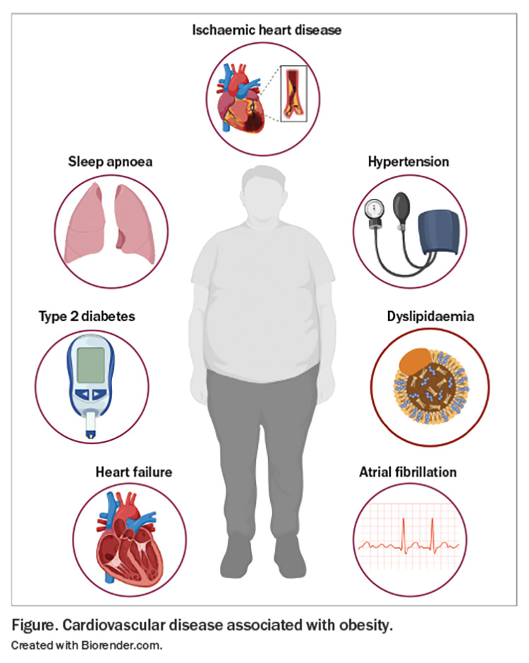 Obesity And Cardiovascular Disease Improving Health Outcomes Endocrinology Today 7191